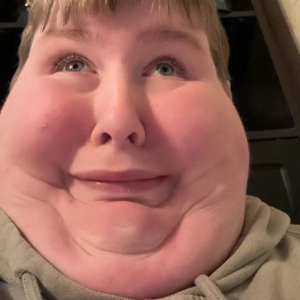 zaglotiks